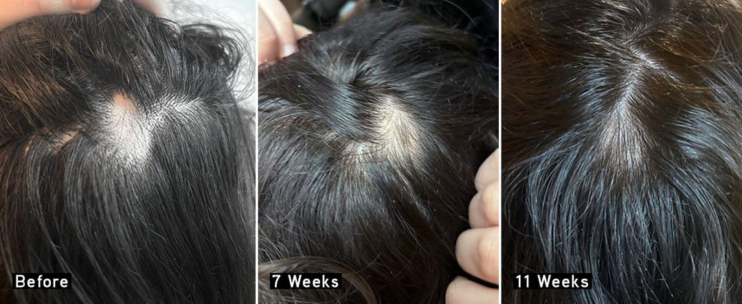 Iles Formula Scalp + Hair Rejuvenating Booster